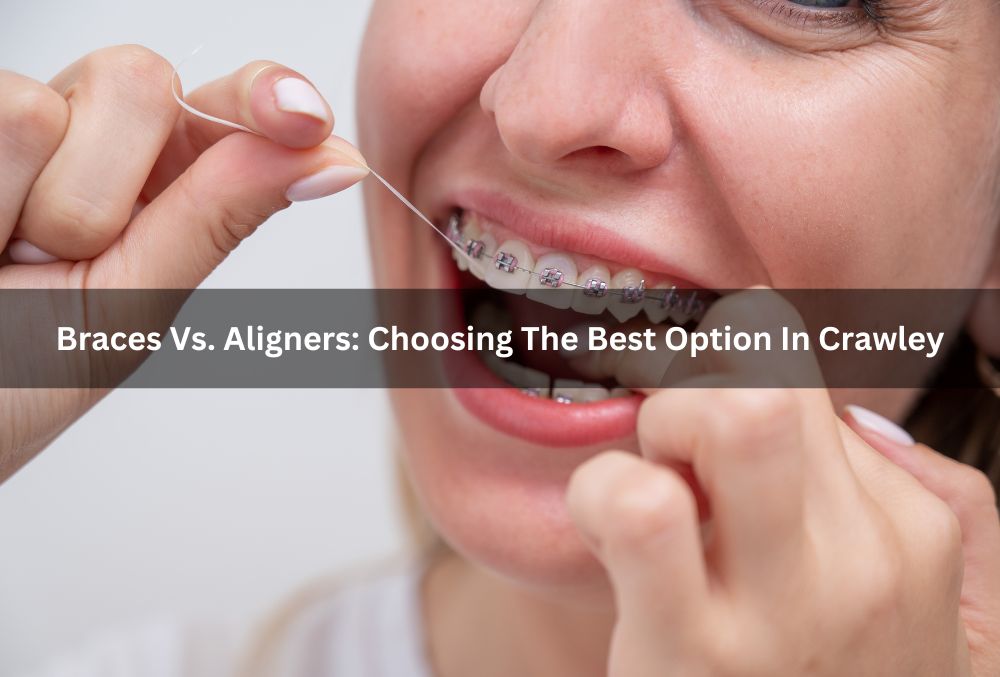 Braces Vs. Aligners: Choosing The Best Option In Crawley