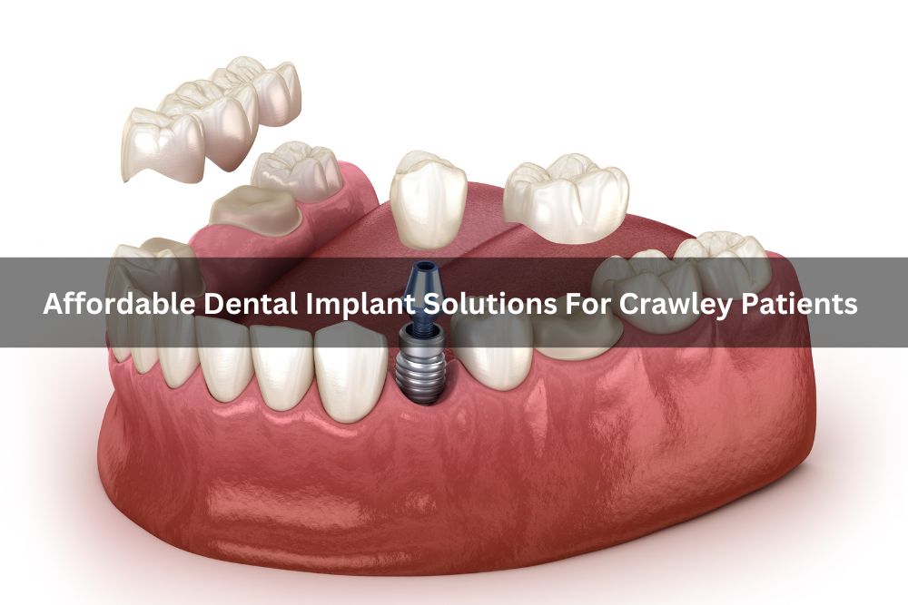 Affordable Dental Implant Solutions For Crawley Patients