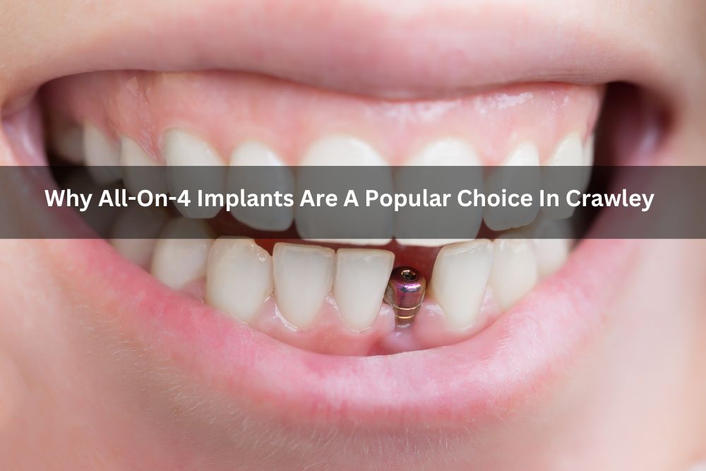 Why All-On-4 Implants Are A Popular Choice In Crawley